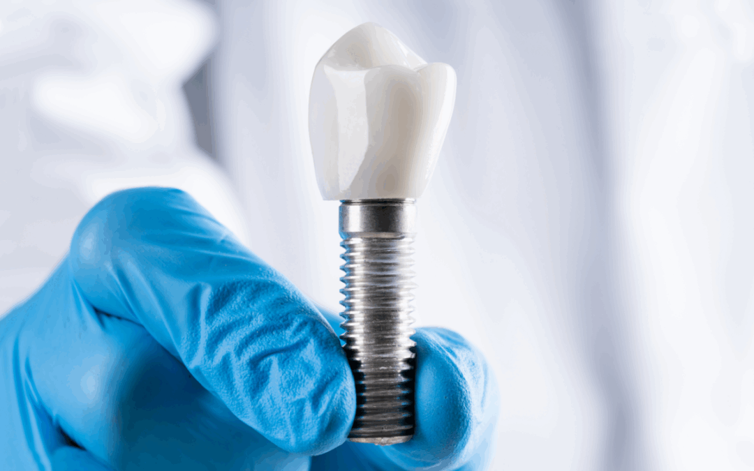 Can Dental Implants Be Removed?