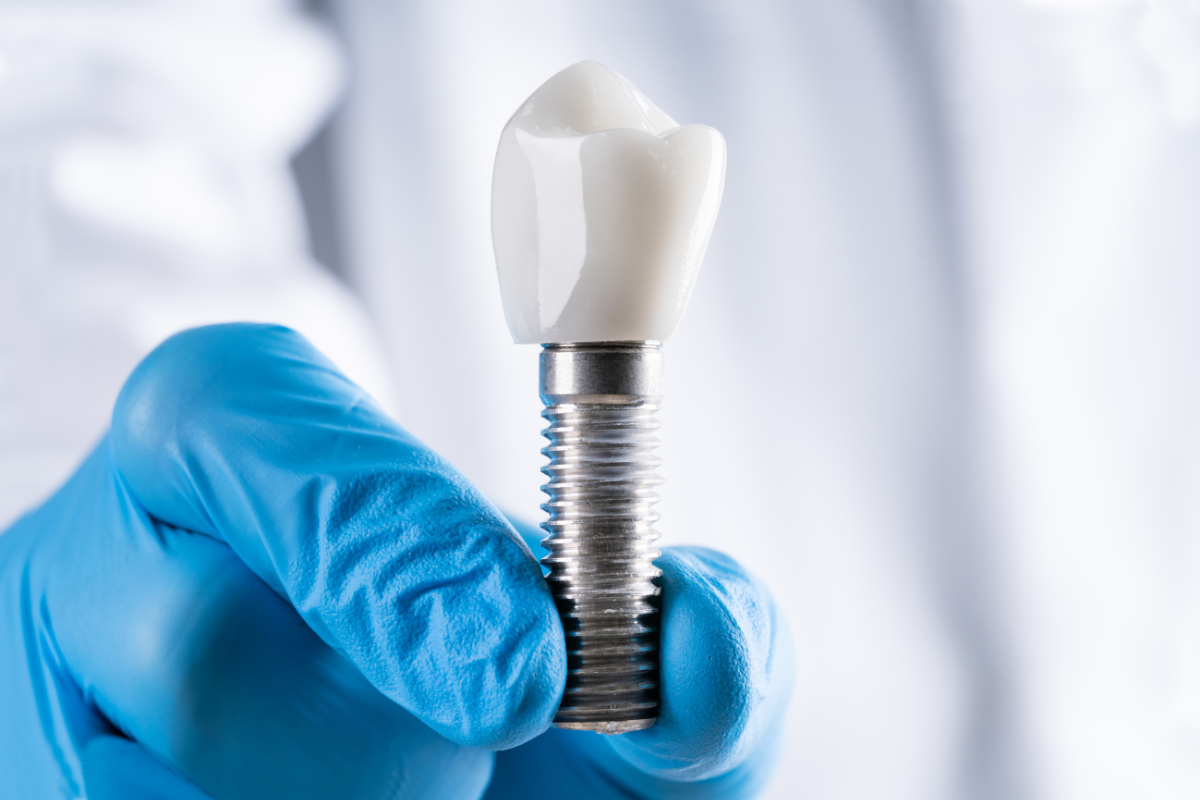 Can Dental Implants Be Removed? Can Dental Implants Be Removed