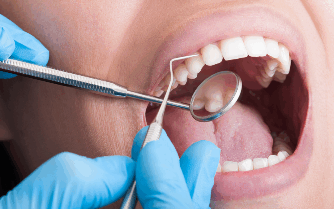 Can a Dentist Help With Bad Breath Permanently?