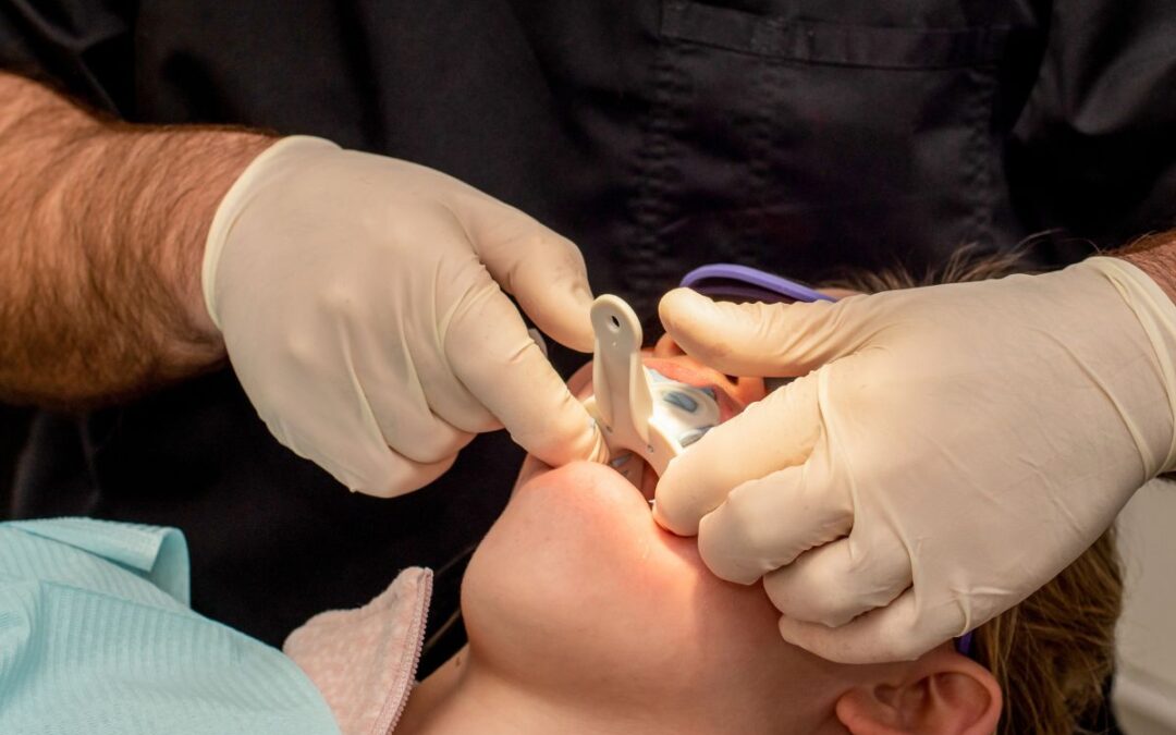 What Are Screwless Dental Implants?