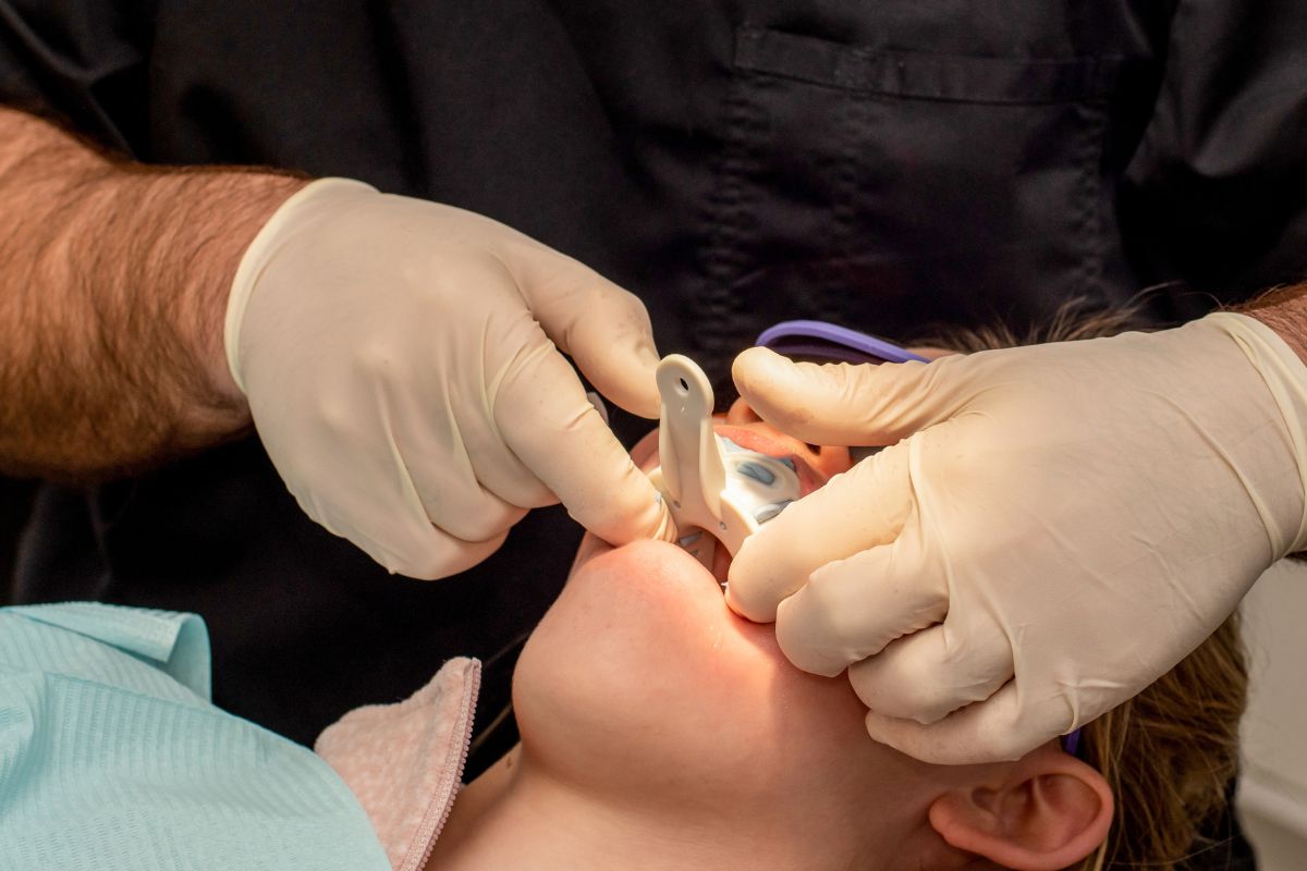 Can Teeth Rot Under Composite Bonding Can Teeth Rot Under Composite Bonding