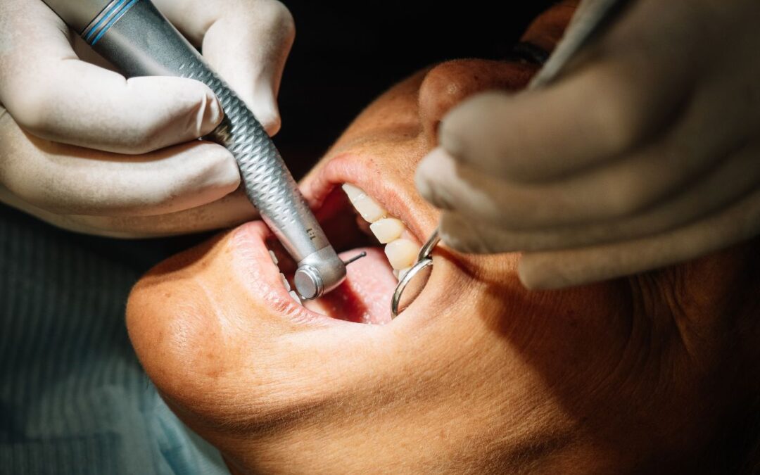 Are Regular Dental Cleanings with a Dentist Necessary?