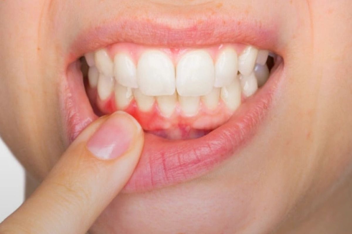 How Do Dentists Check for a Tooth Infection