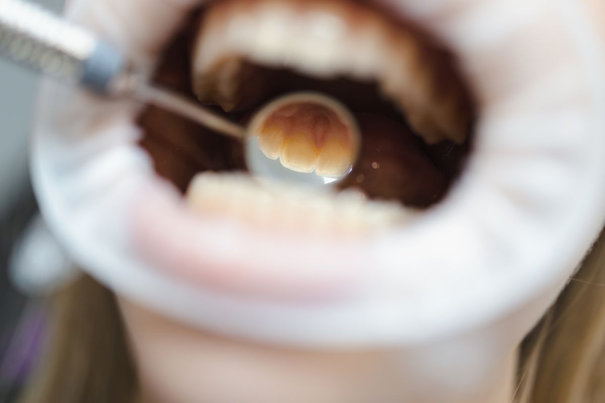 Dental Cleanings in Bixby