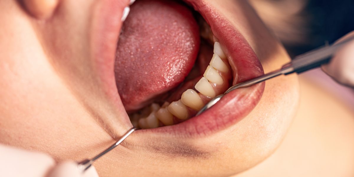 Why Is One Tooth Suddenly Turning a Different Color Than the Rest