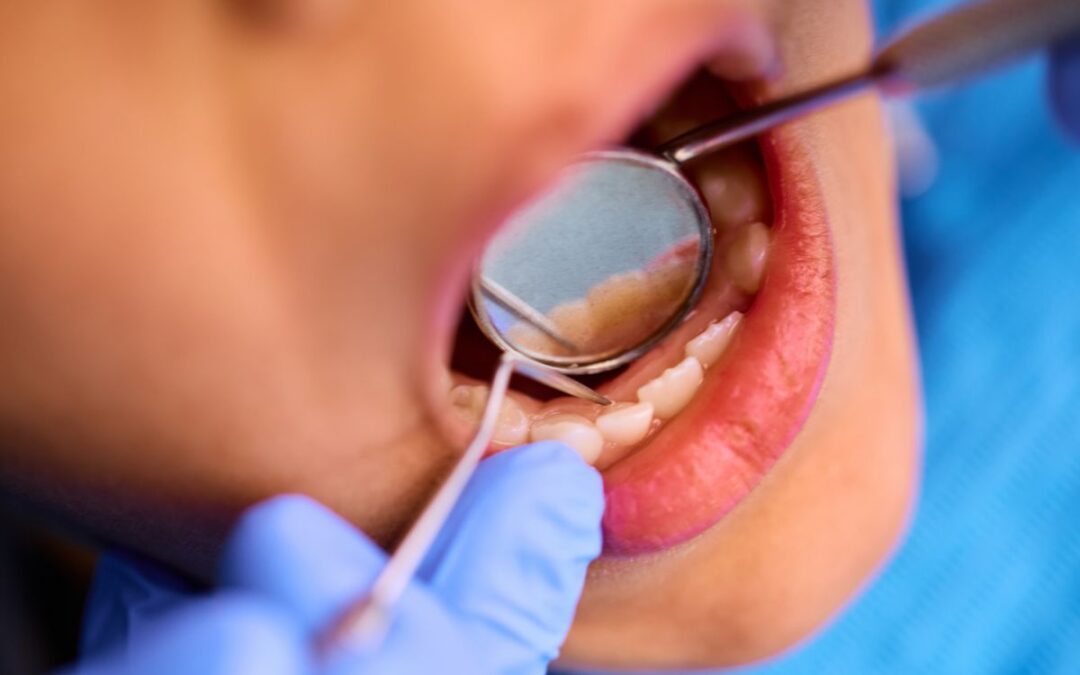 The Sleep–Dental Connection: Why Your Dentist May Detect Sleep Apnea First
