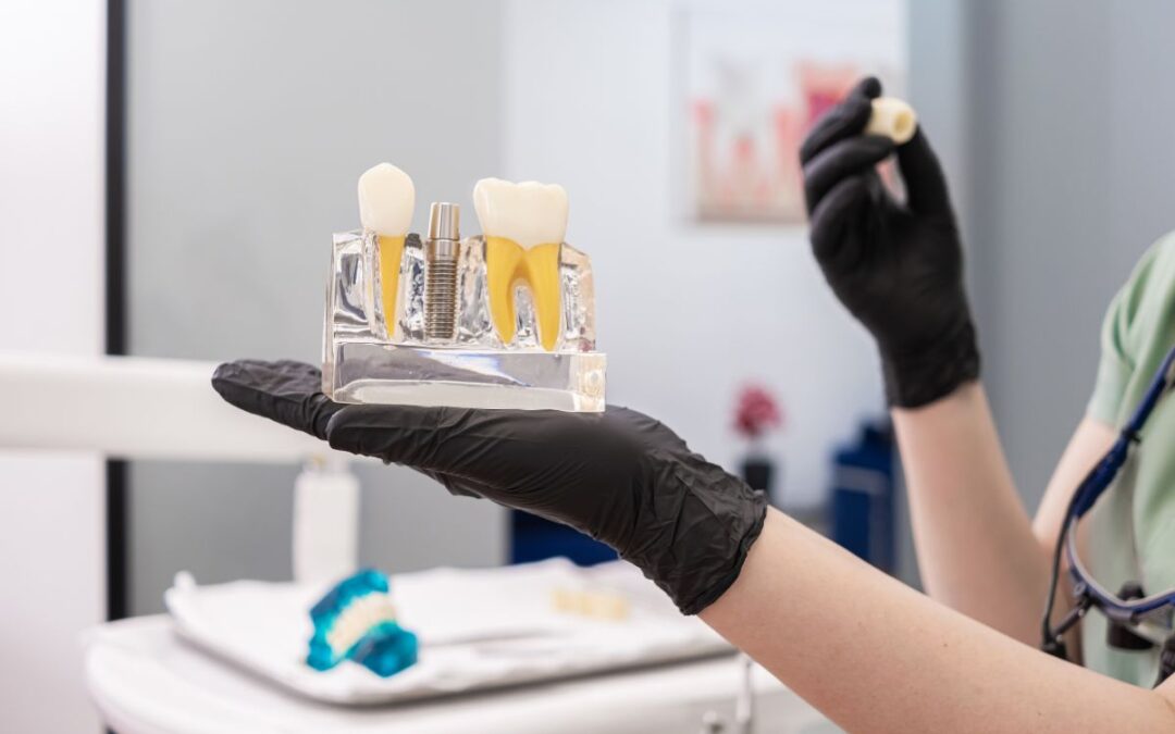 How Long Does Dental Implant Surgery Take?